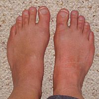 My feet