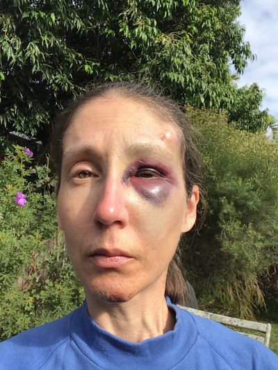 Injuries, 14/5/2020